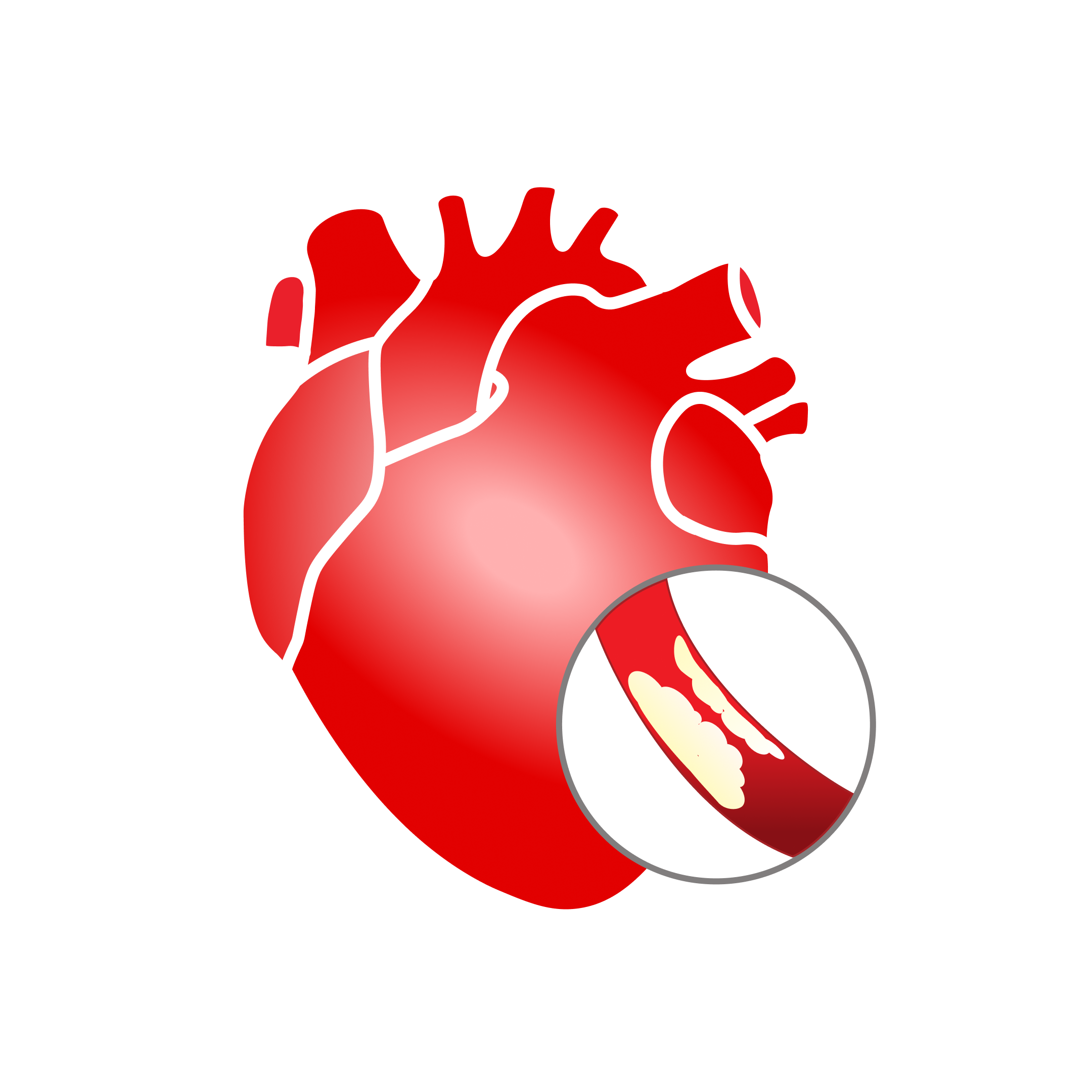 Atrial Septal Defect (ASD) / Ventricular Septal Defect (VSD)