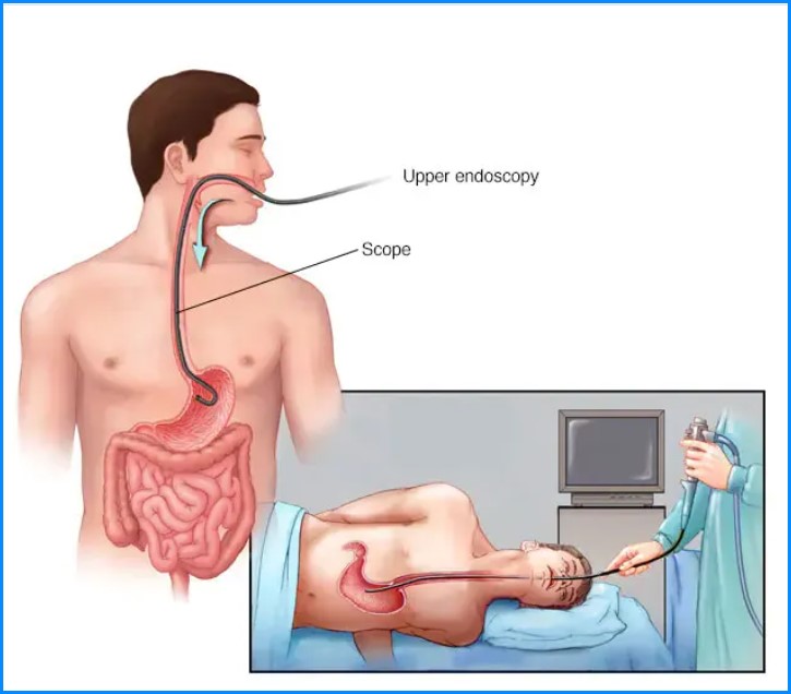 Gastroscopy