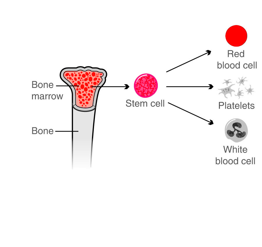 Bone Marrow Transplant
