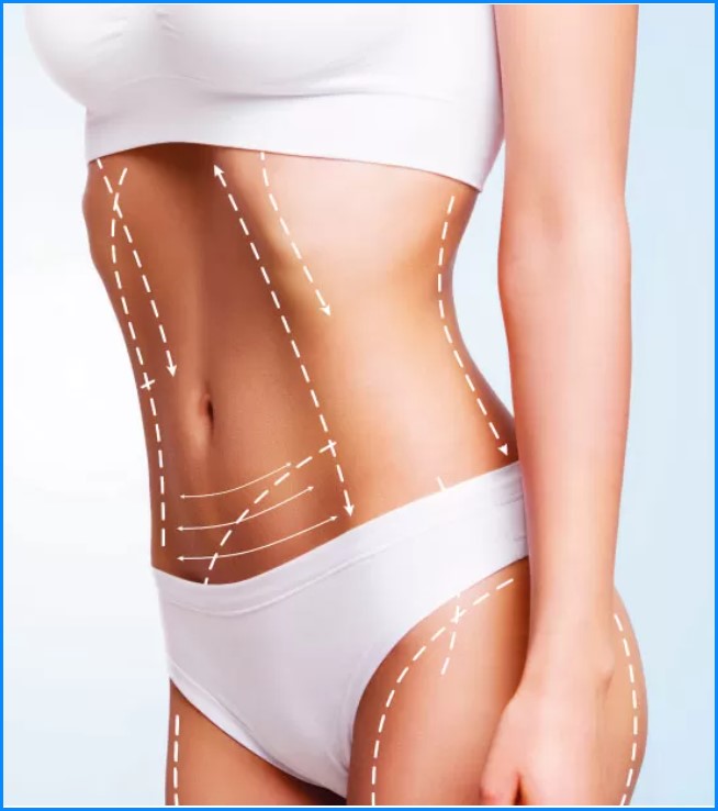 Vaser Liposuction