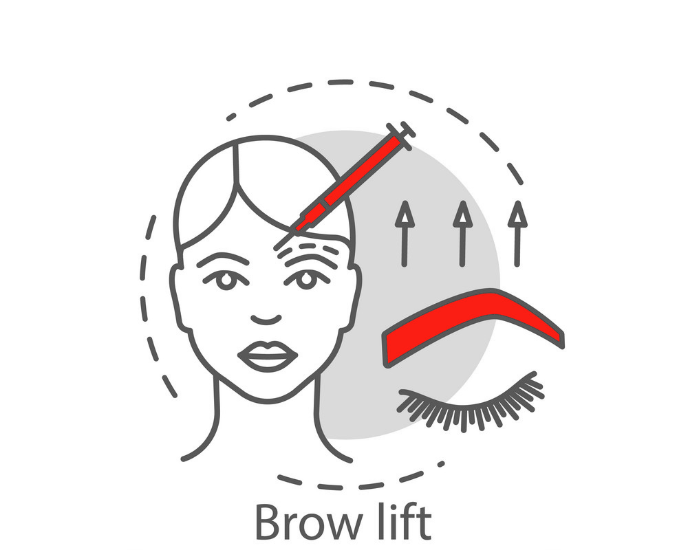 Brow Lift