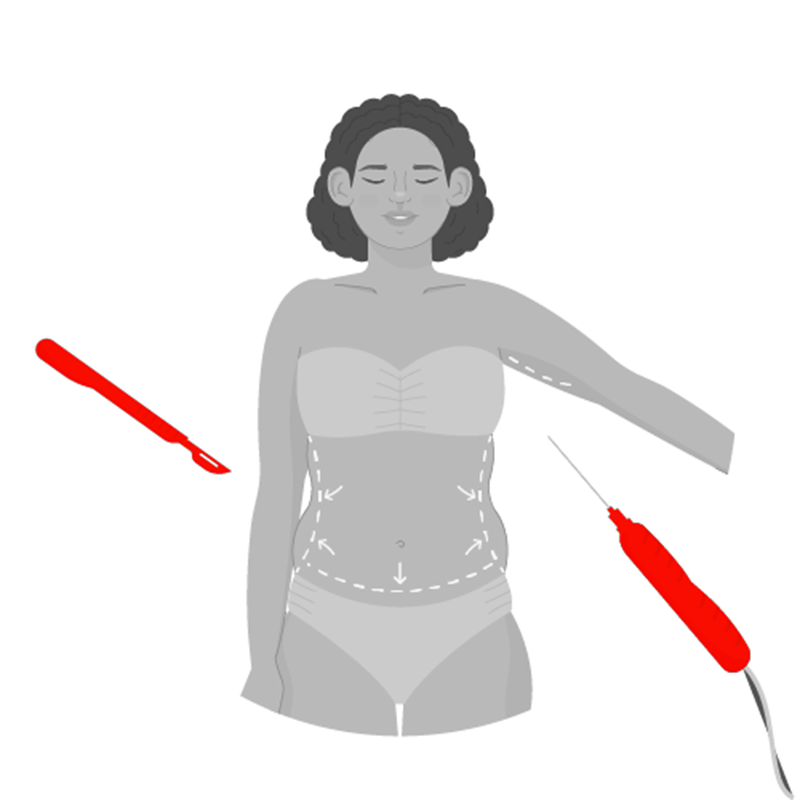Liposuction