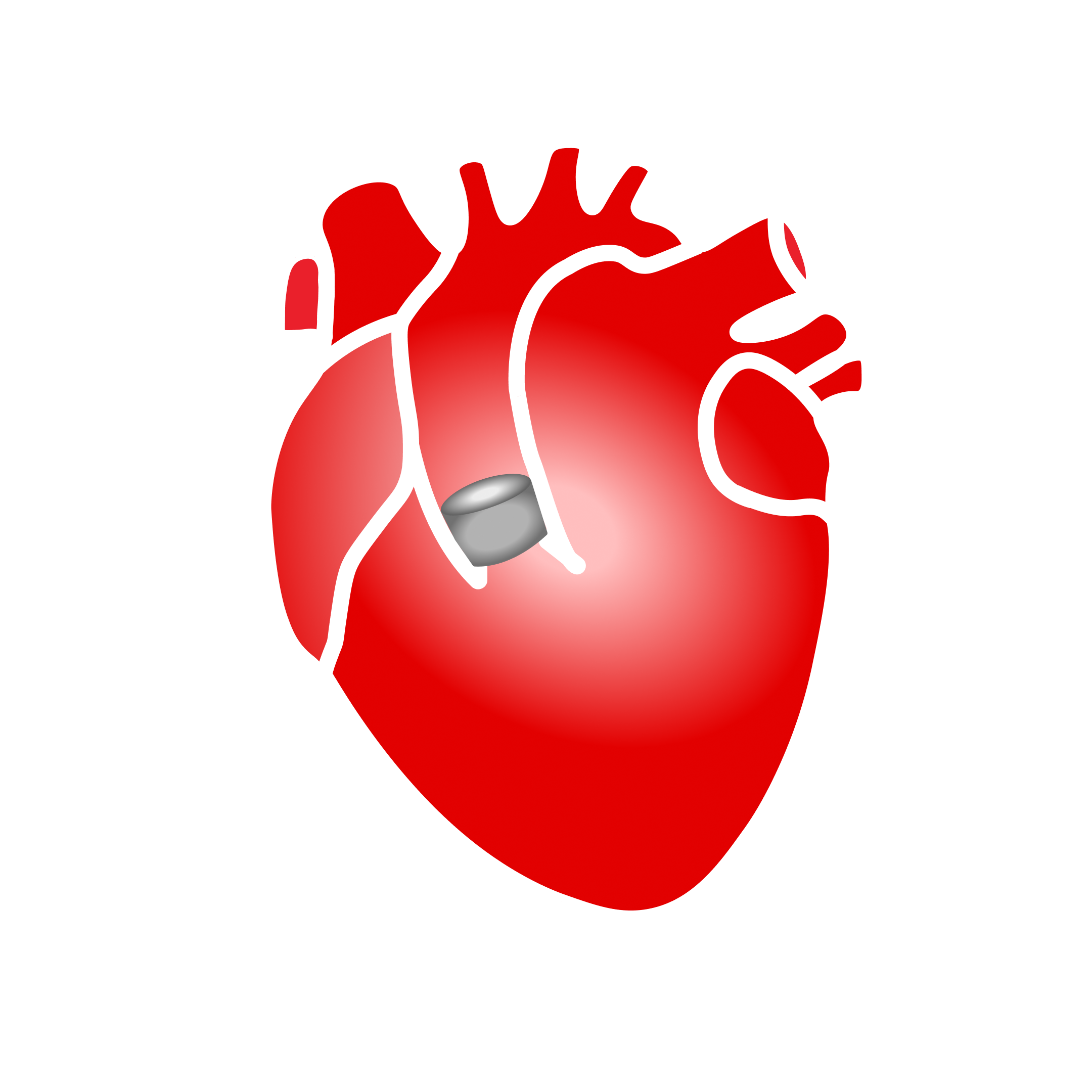 Interventional Cardiology