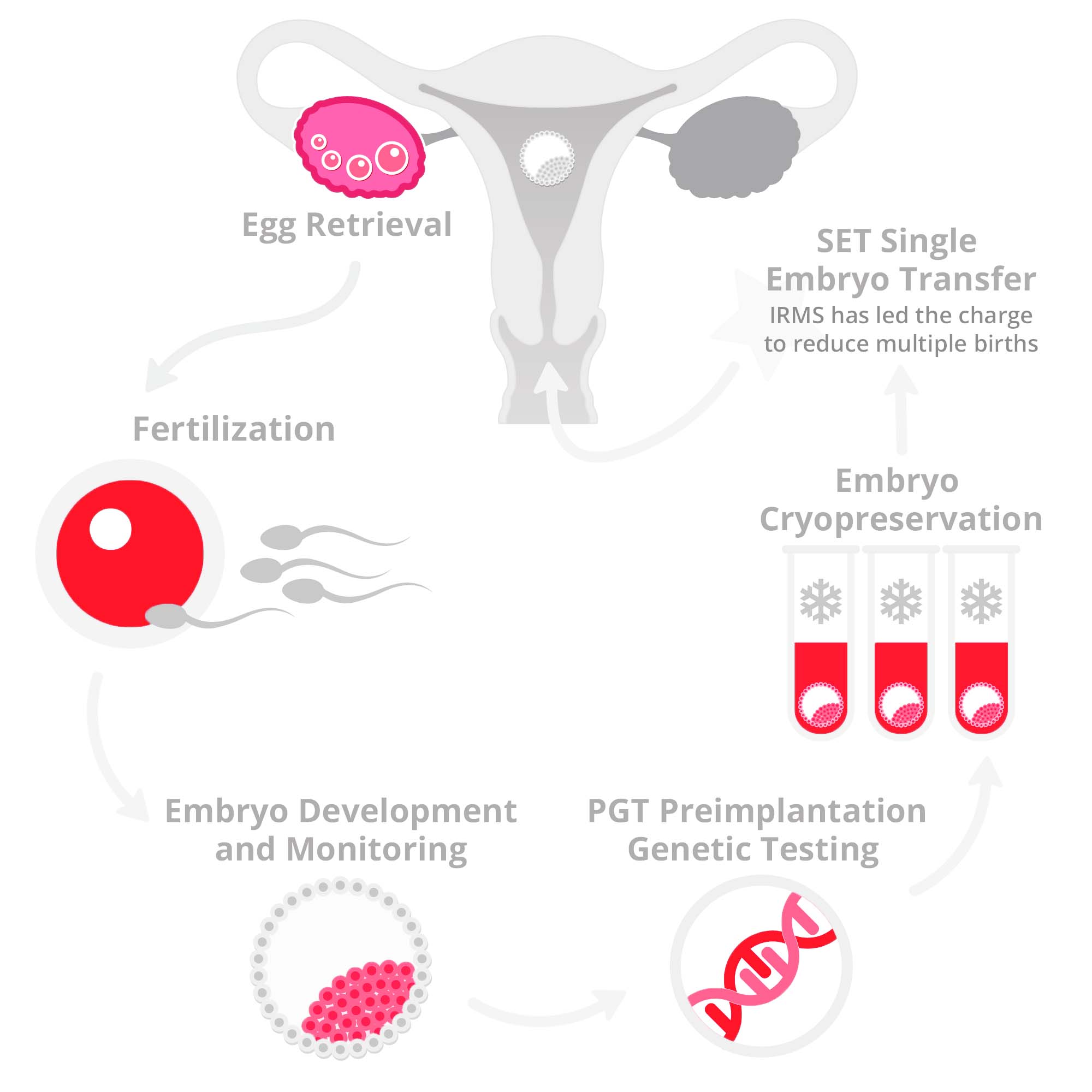 IVF